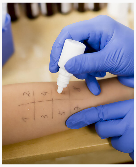 allergologia