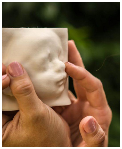 ecografia-3d